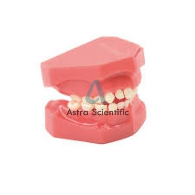 Deciduous Teeth Model