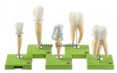 Five Models of Teeth